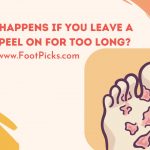 What Happens If You Leave a Foot Peel on for Too Long