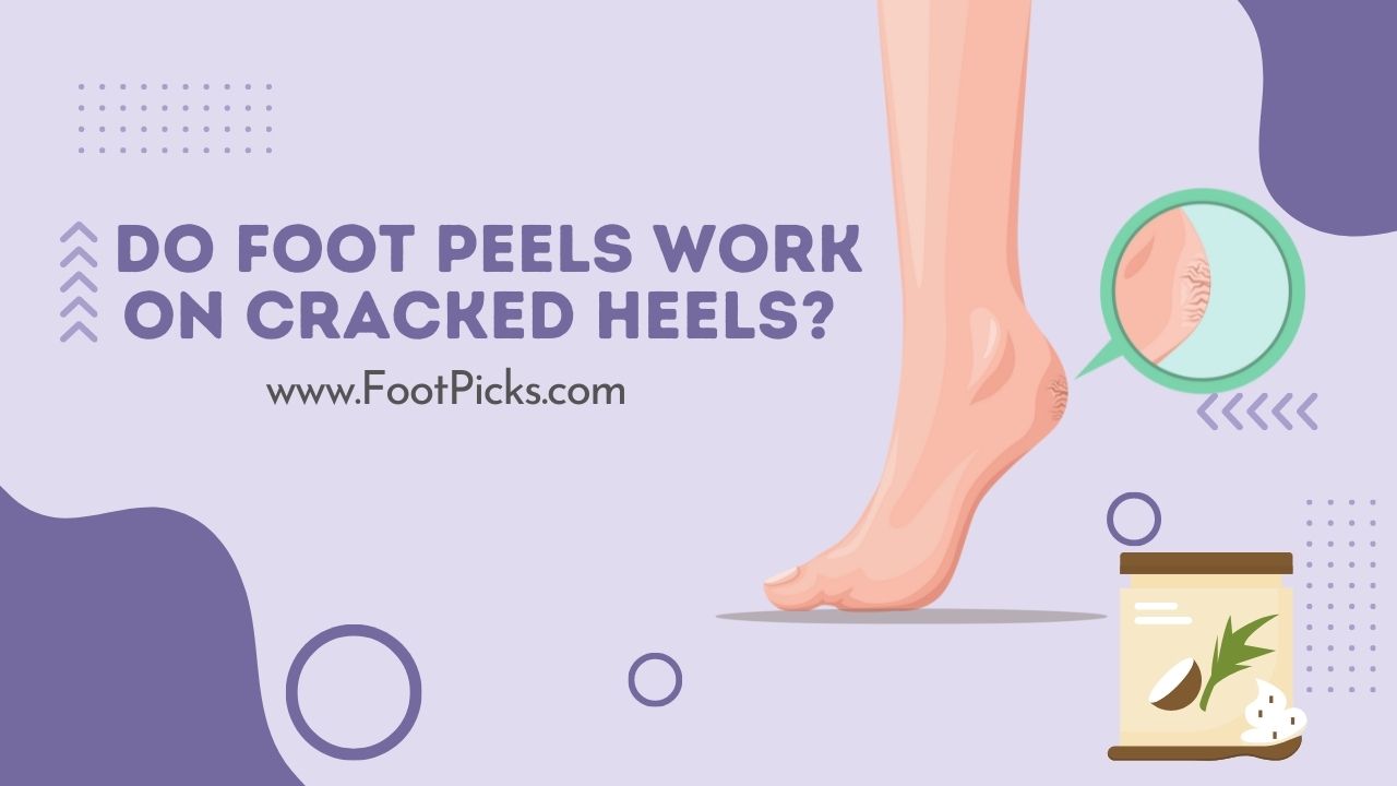Do Foot Peels Work on Cracked Heels